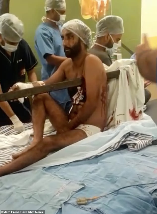 A CT scan found Hardeep suffered a broken rib and broken scapula, but incredibly the rod missed all of his vital organs