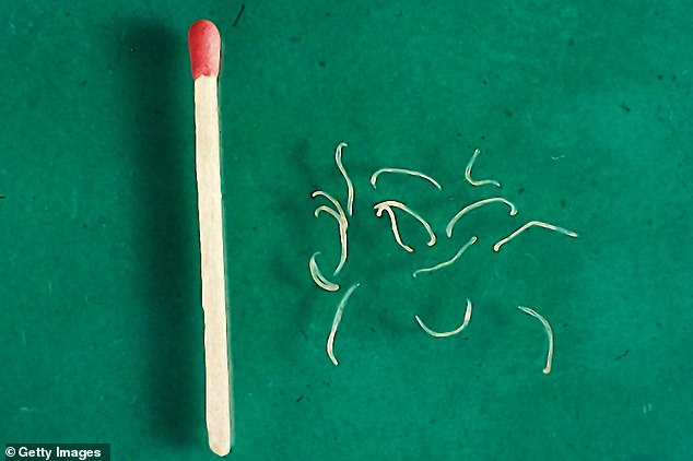 Adult hook worms outside the body. The disease the boy contracted is caused by the larvae, which are even smaller than this