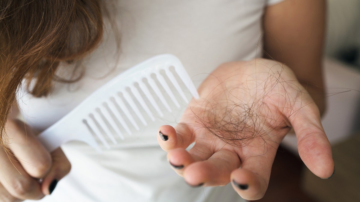 Woman losing hair on hairbrush in hand