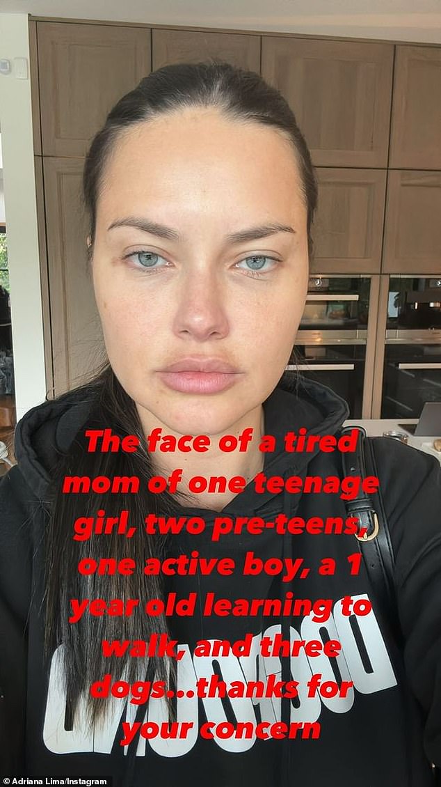 Following online discussions about her appearance last year, the supermodel took to Instagram to break her silence over plastic surgery rumors