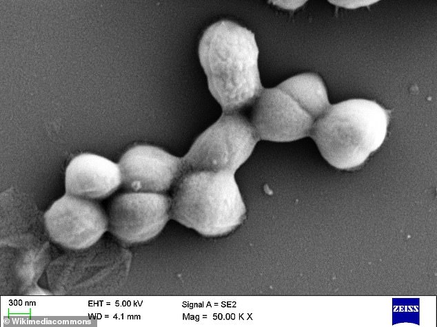 Pictured, Micrococcus luteus, a bacterium that's typically non-pathogenic but can cause opportunistic infections in people who have a weakened immune system (file photo)