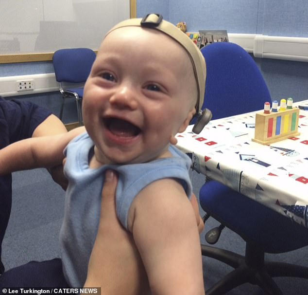 A bone anchored hearing aid, is a type of hearing implant that's fitted to the skull. It's used for people with hearing loss caused by sound being unable to reach your inner ear, the NHS says. Henri did try this type of hearing aid before but used to remove it when he was young