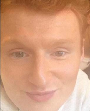 Jack Castell, 24, before he had multiple plastic surgeries on his face in Turkey