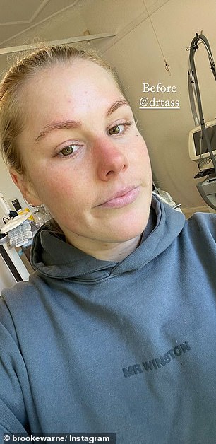 Next up, it was time for some facial rejuvenation. Brooke took herself off to a Melbourne skin clinic for a dermal glow treatment