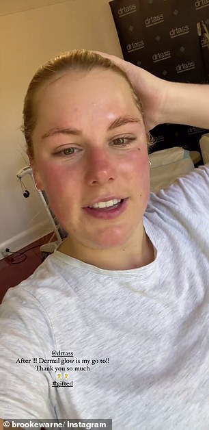 Next up, it was time for some facial rejuvenation. Brooke took herself off to a Melbourne skin clinic for a dermal glow treatment