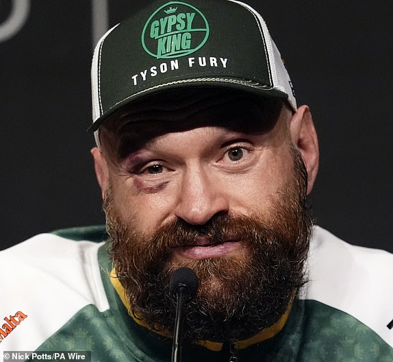 Tyson Fury during a press conference following his defeat to Oleksandr Usyk at the Kingdom Arena in Riyadh, Saudi Arabia. Picture date: Saturday December 21, 2024. PA Photo. See PA story BOXING Fury. Photo credit should read: Nick Potts/PA Wire.RESTRICTIONS: Use subject to restrictions. Editorial use only, no commercial use without prior consent from rights holder.