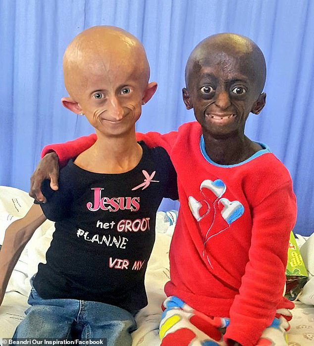 Beanadri with fellow sufferer Ontlametse Phalatse. The two  had been close friends before Phalatse died last year from the mutation aged 18 and was the only black sufferer in South Africa