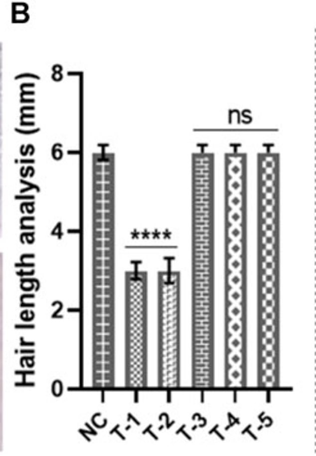 This analysis measures how long the hair grew in skin samples from different treatment groups, including the one treated with the experimental gel (T-3). There was a big difference in hair growth between the NC group and T-1 and T-2. There was no noticeable difference between the NC group and T-3 (the group treated with the experimental gel) or other treatment groups