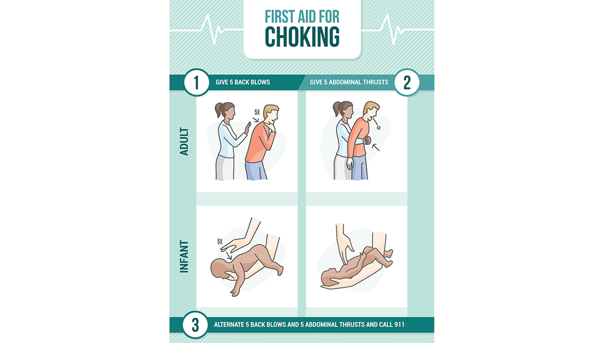 Heimlich maneuver guide