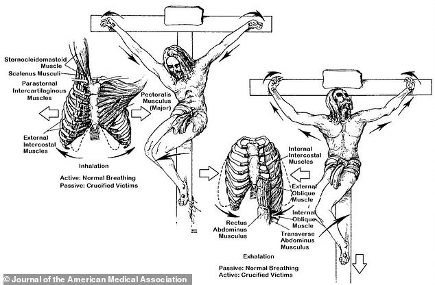 A study from 1986 determined Jesus died from exhaustion asphyxia